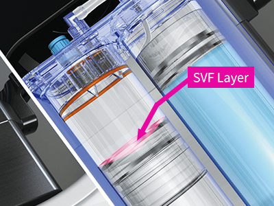 트리니티 SVF 자동분리 시스템 핵심 구조